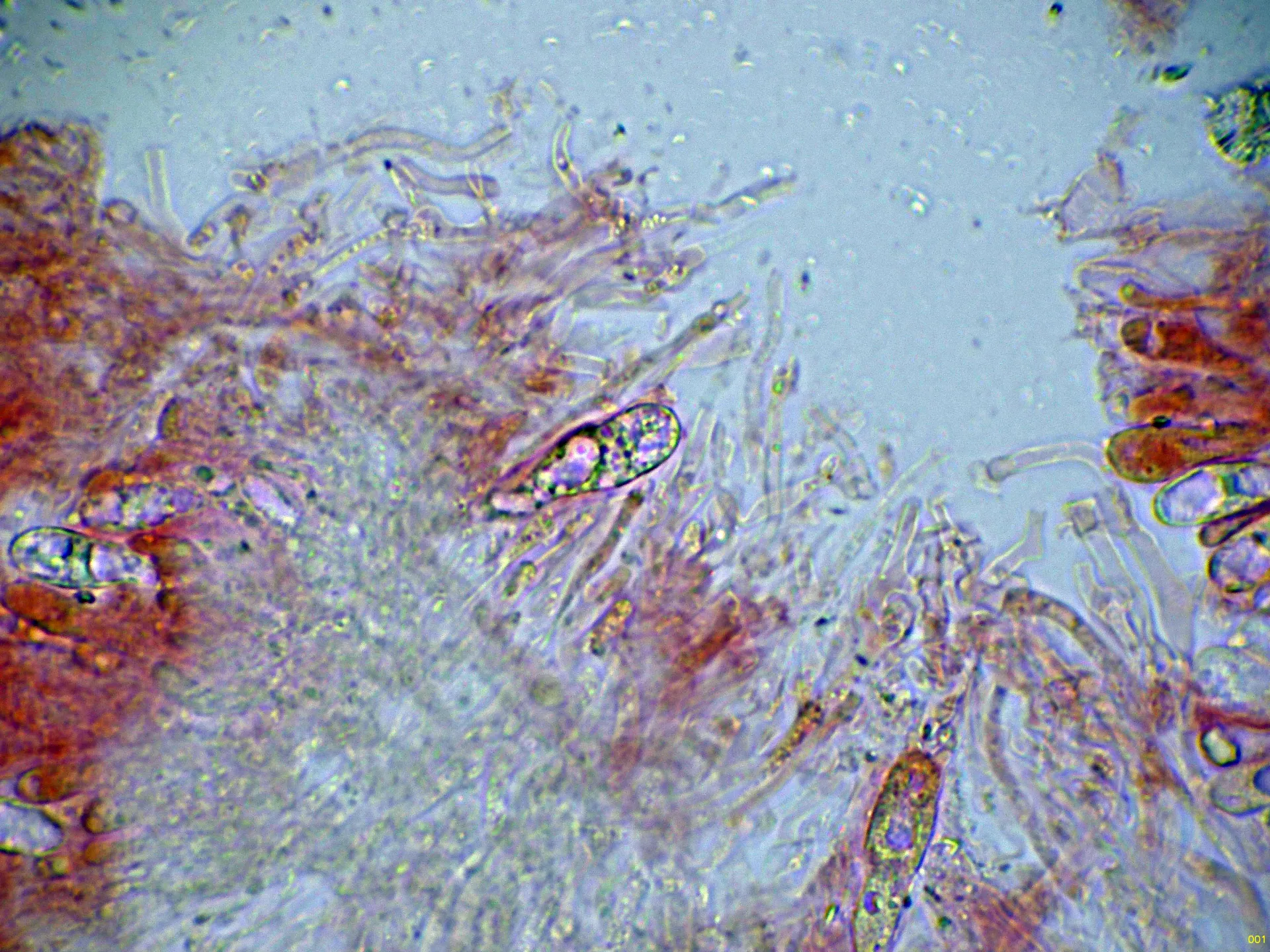 Microscopía de Resupinatus poriaeformis - 10 - Hifas subiculares-001